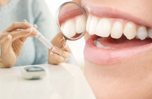 relación diabetes problemas dientes